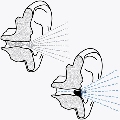 Calmer - helitundlikkuse vähendamiseks